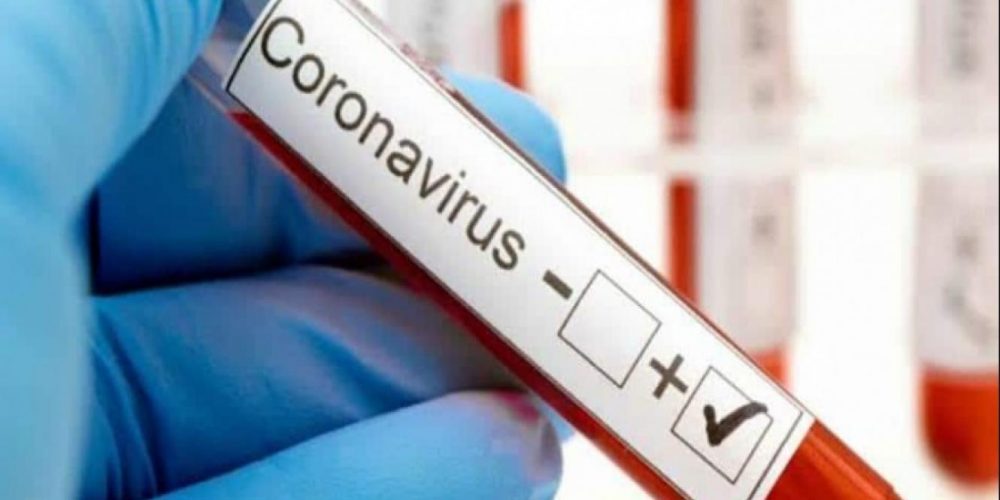 Coronavirus en el país: confirmaron 5 muertes y 641 contagios en las últimas 24 horas