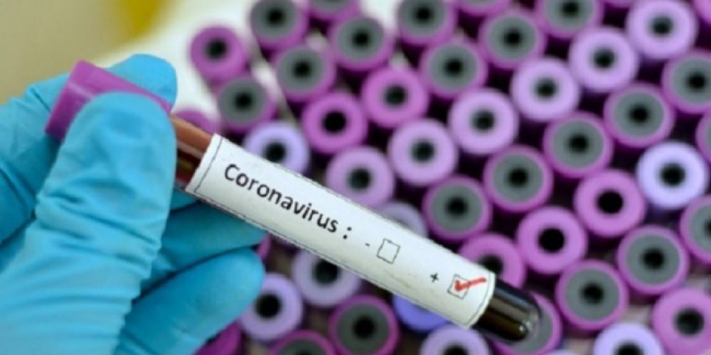 Confirmaron tres nuevos casos de coronavirus en Entre Ríos