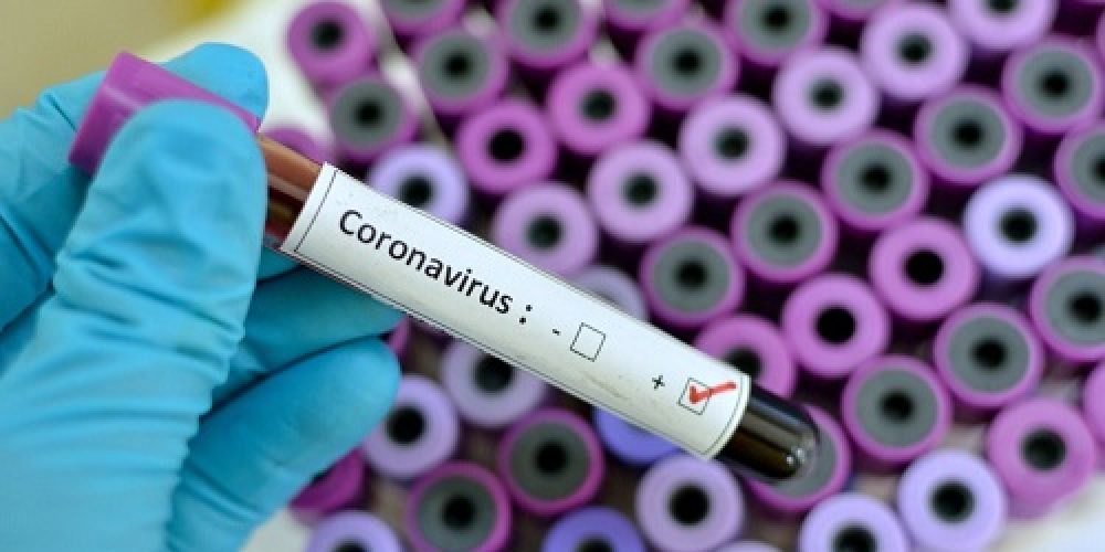 Advierten que la población joven y activa es la que más se infecta de coronavirus