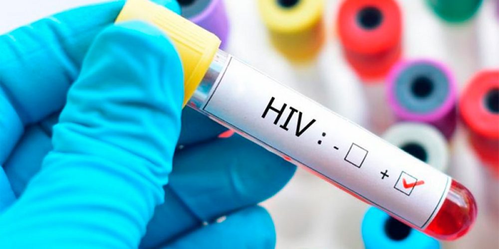 VIH: El 98% de las nuevas infecciones son por relaciones sexuales sin protección