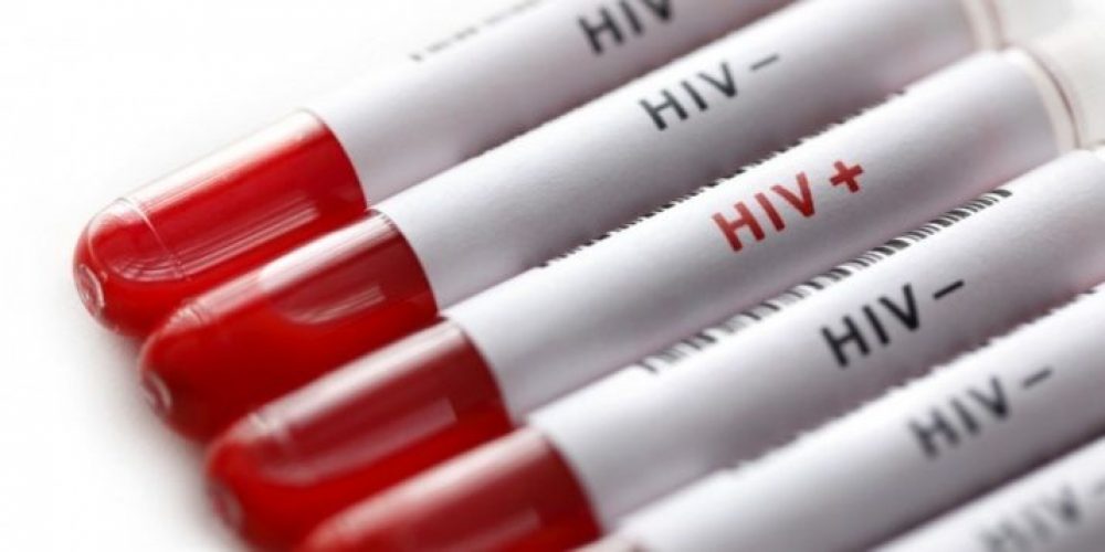 En Entre Ríos están garantizados los estudios y controles a pacientes con HIV