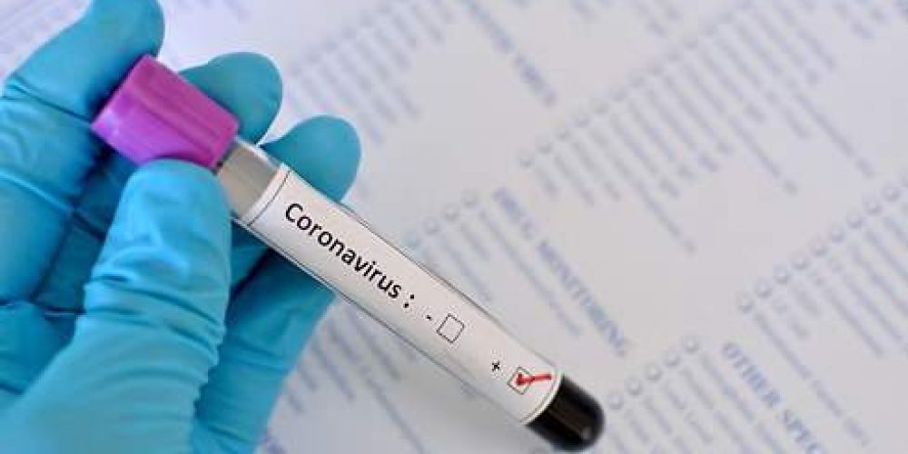 Entre el viernes y lunes se registraron 53 nuevos casos de coronavirus en Entre Ríos