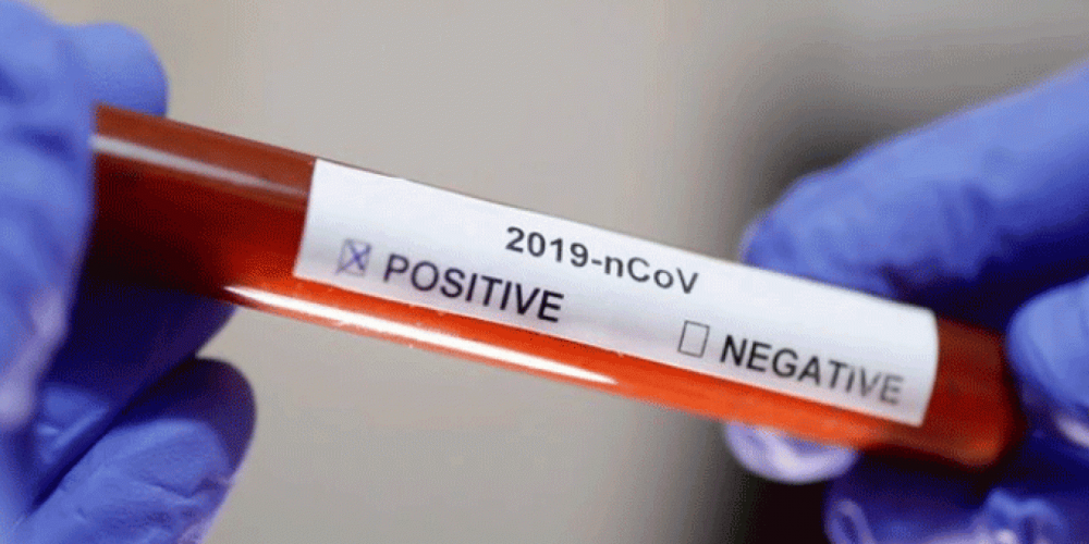 Coronavirus: confirmaron el primer caso positivo en Paraná
