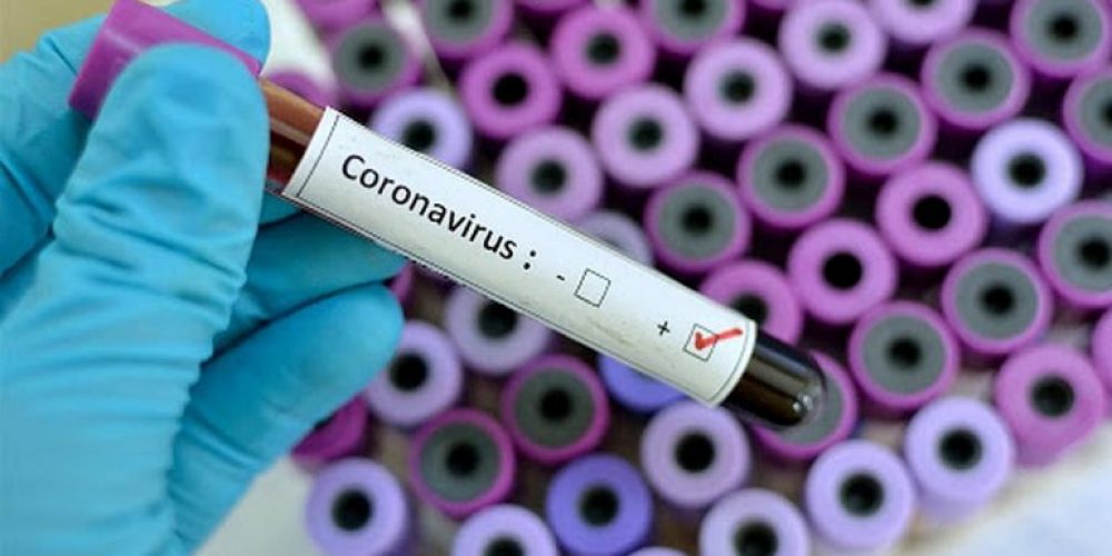 Detallaron el estado de salud del paciente con coronavirus en Paraná