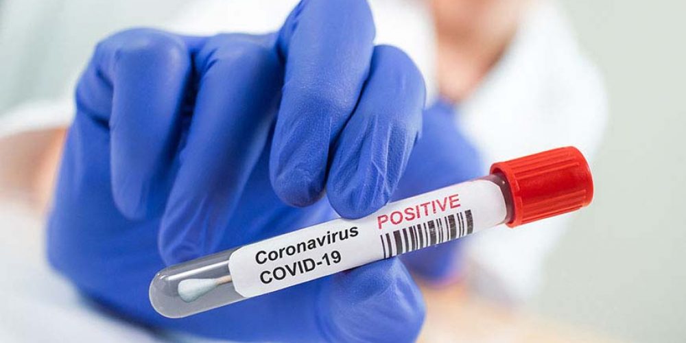 Coronavirus en Argentina: 113 muertes y 8.160 nuevos contagios reportados este viernes